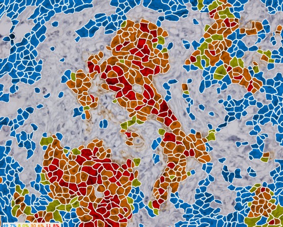 APPLIED SPECTRAL IMAGING HiPath in India