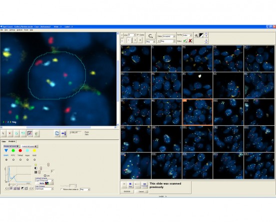 APPLIED SPECTRAL IMAGING Spotscan (Solid FISH) in India