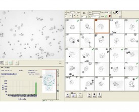 Metaphase Finder