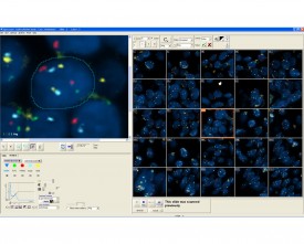 Spotscan (Liquid FISH)