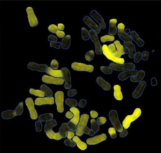 Spectral karyotyping