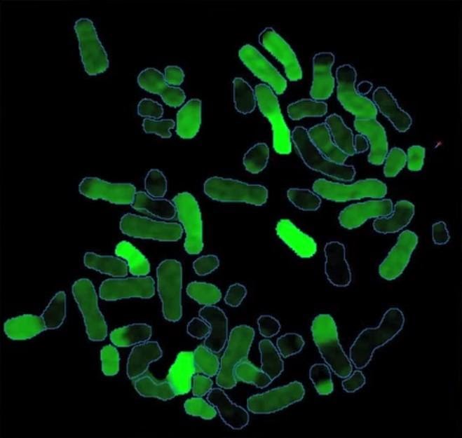 Spectral karyotyping