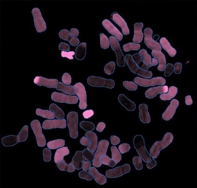 Spectral karyotyping