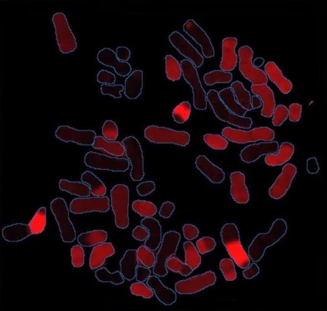 Spectral karyotyping