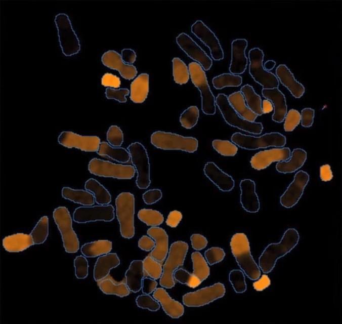 Spectral karyotyping