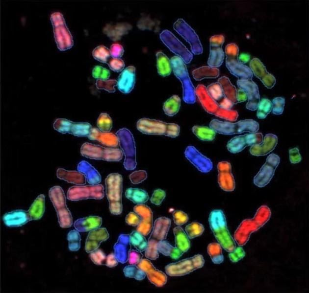 Spectral karyotyping