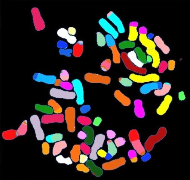 Spectral karyotyping