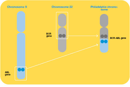 Chronic Myeloid Leukemia