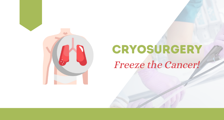 Cryosurgery for Lung Cancer
