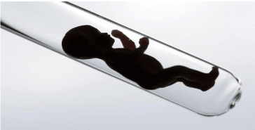 In Vitro Fertilization