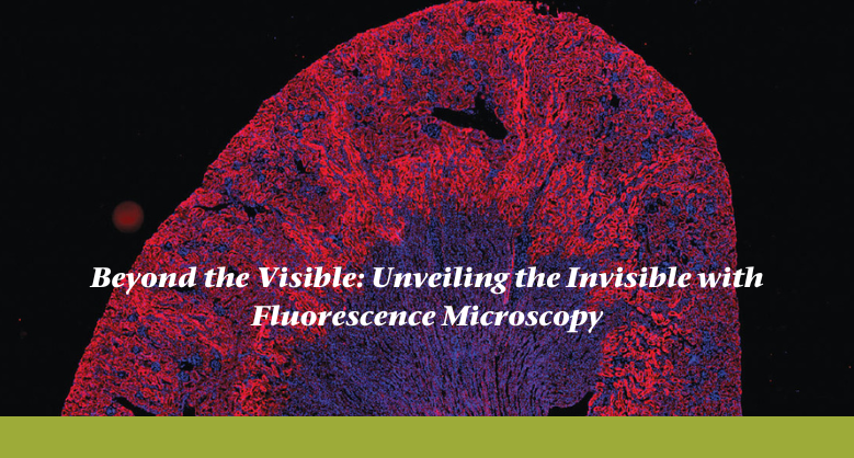 Beyond the Visible: Unveiling the Invisible with Fluorescence Microscopy