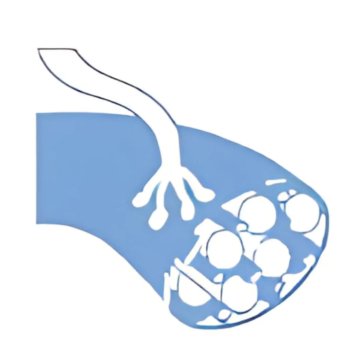 MLPA Assays for Neuromuscular Disorders