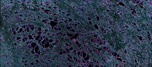 Breast Panel