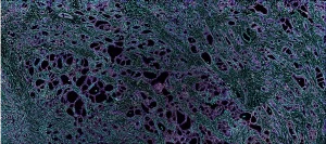 Breast Panel