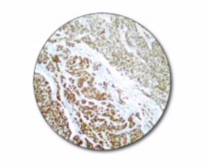 ER/PR pharmDx Kits