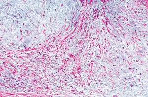 Melanoma panel