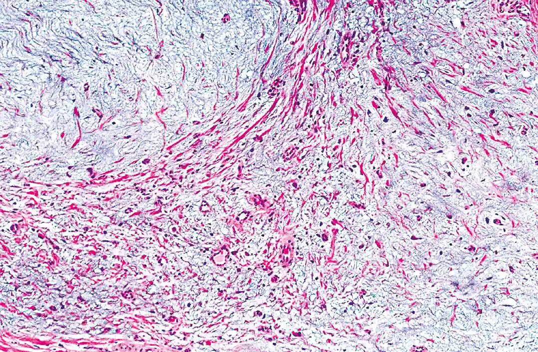 Melanoma panel