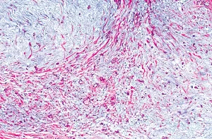 Melanoma panel