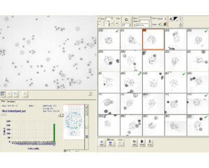 Metaphase Finder