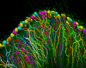 Neurolucida