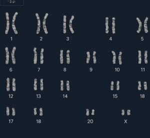 Karyotyping