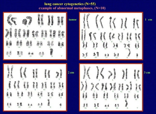 KARYOTYPE