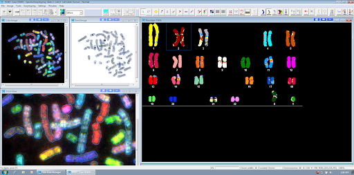 SKY-Karyotype