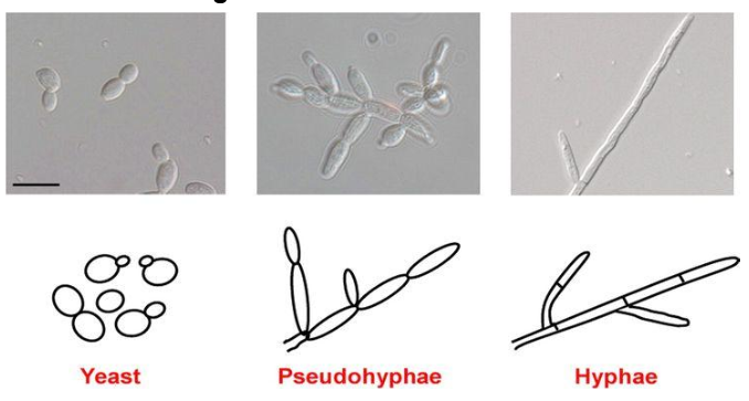 Fungal disease diagnostic image