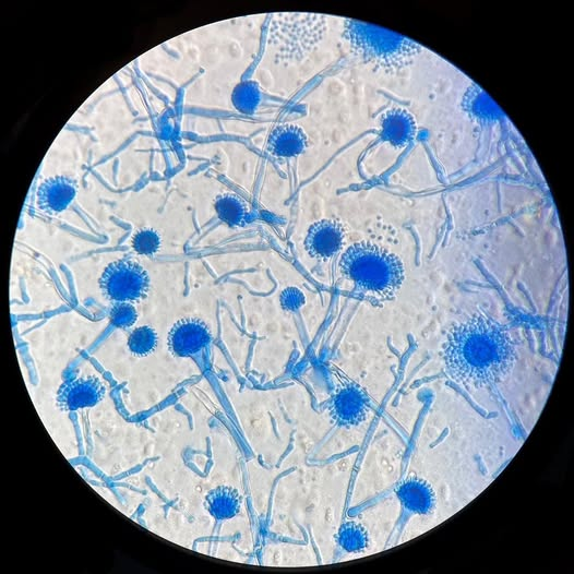 Fungal disease diagnostic image