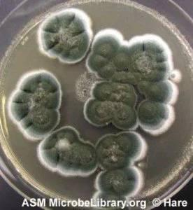 Fungal disease diagnostic image